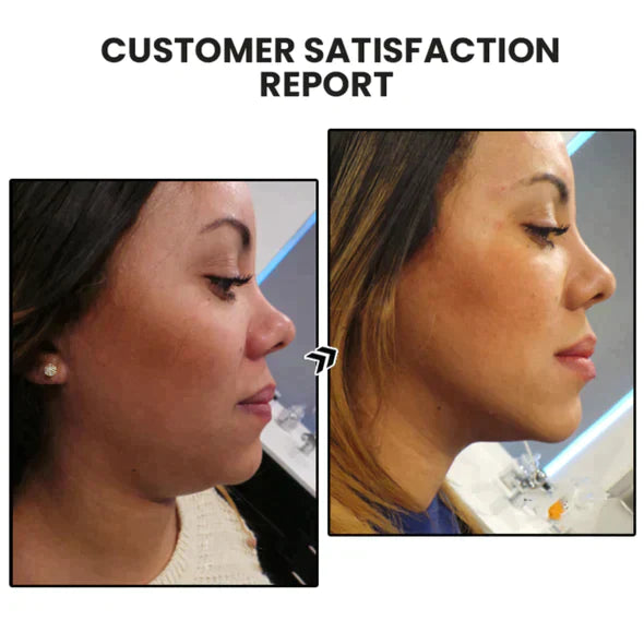 (🔥LAST DAY SALE-80% OFF) Cishx™ Lymphvity MagneTherapy Germanium Earrings